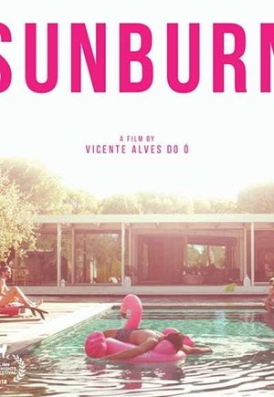 Sunburn